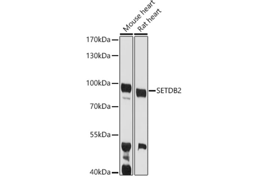 Western Blot - Anti-CLLD8/SETDB2 Antibody (A10134) - Antibodies.com