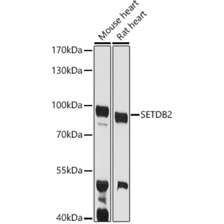 Western Blot - Anti-CLLD8/SETDB2 Antibody (A10134) - Antibodies.com