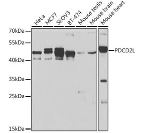 Western Blot - Anti-PDCD2L Antibody (A10135) - Antibodies.com