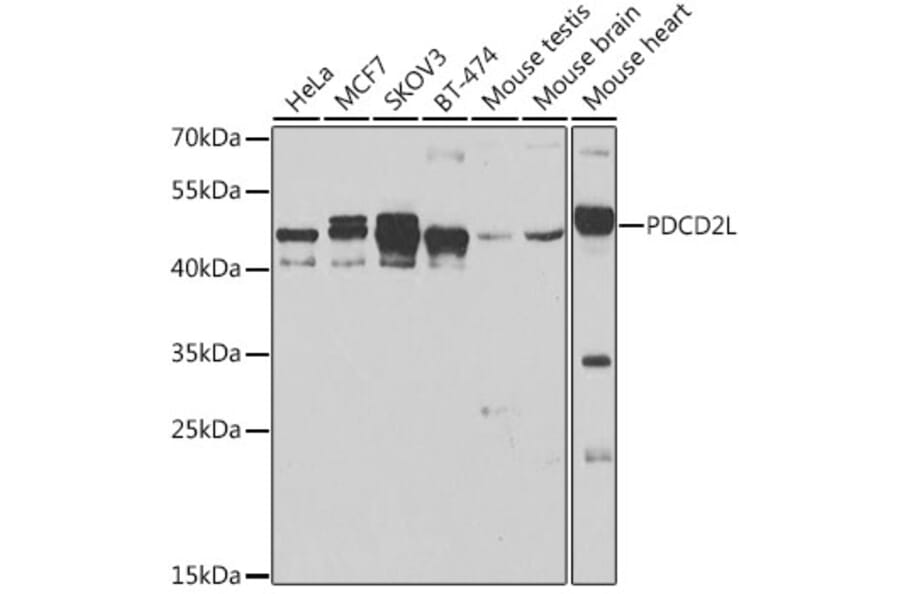 Western Blot - Anti-PDCD2L Antibody (A10135) - Antibodies.com