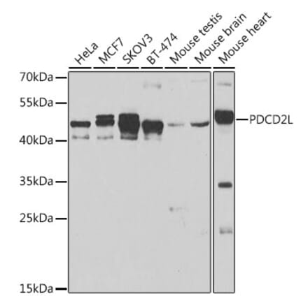 Western Blot - Anti-PDCD2L Antibody (A10135) - Antibodies.com