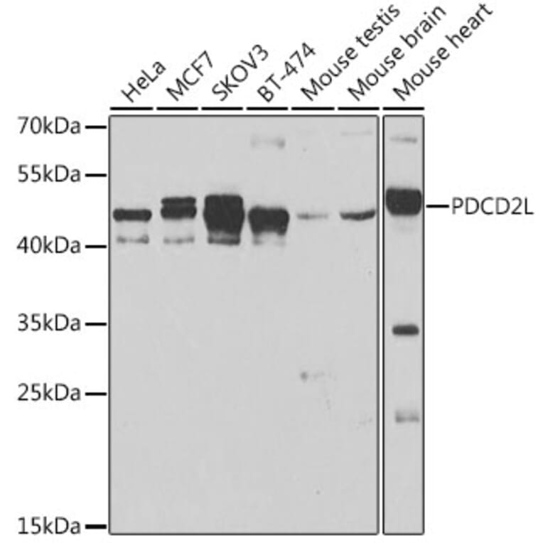 Western Blot - Anti-PDCD2L Antibody (A10135) - Antibodies.com