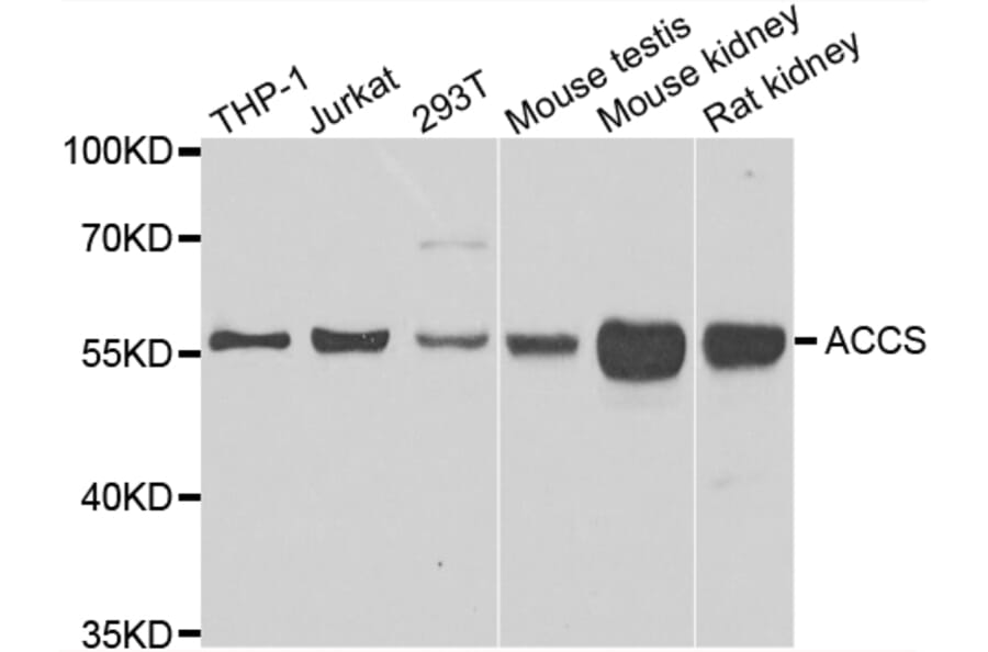 Western Blot - Anti-ACCS Antibody (A7395) - Antibodies.com
