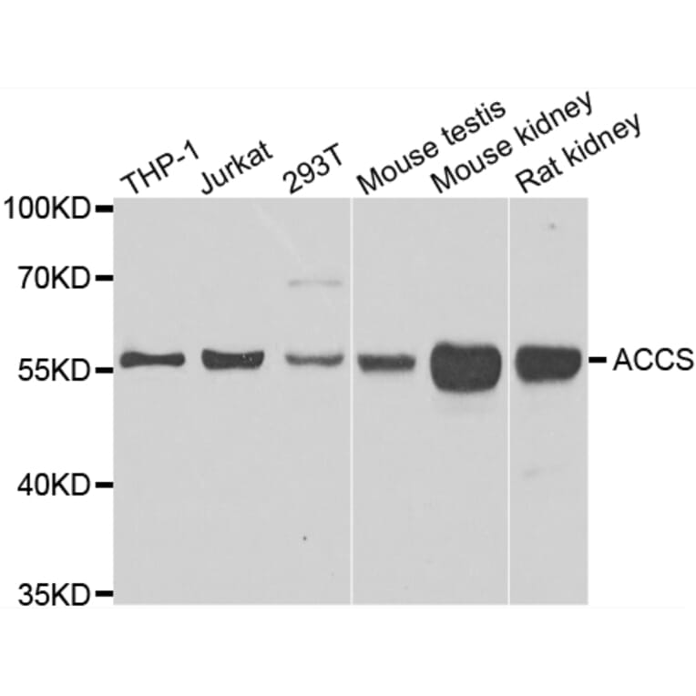 Western Blot - Anti-ACCS Antibody (A7395) - Antibodies.com