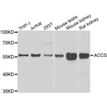 Western Blot - Anti-ACCS Antibody (A7395) - Antibodies.com