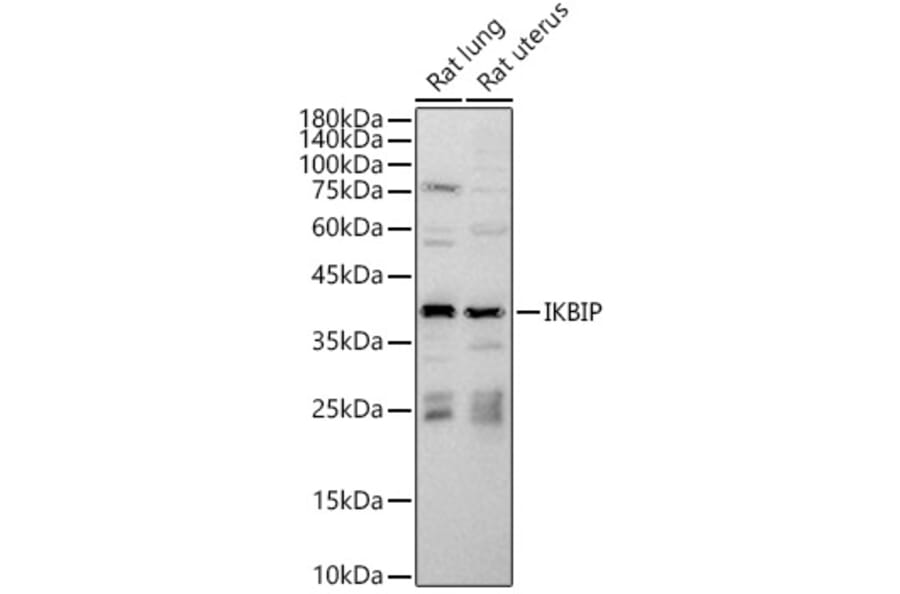 Western Blot - Anti-IKIP Antibody (A10138) - Antibodies.com