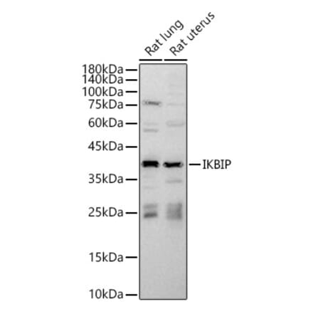 Western Blot - Anti-IKIP Antibody (A10138) - Antibodies.com