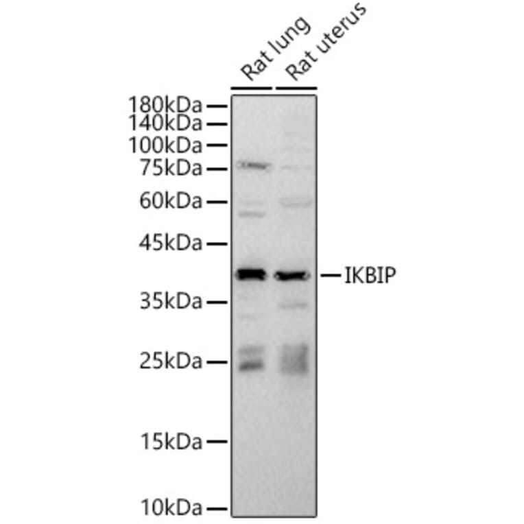 Western Blot - Anti-IKIP Antibody (A10138) - Antibodies.com