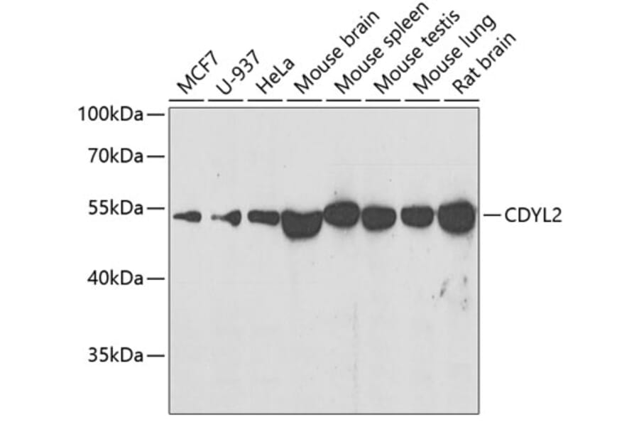Western Blot - Anti-CDYL2 Antibody (A10139) - Antibodies.com
