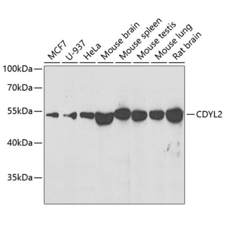 Western Blot - Anti-CDYL2 Antibody (A10139) - Antibodies.com