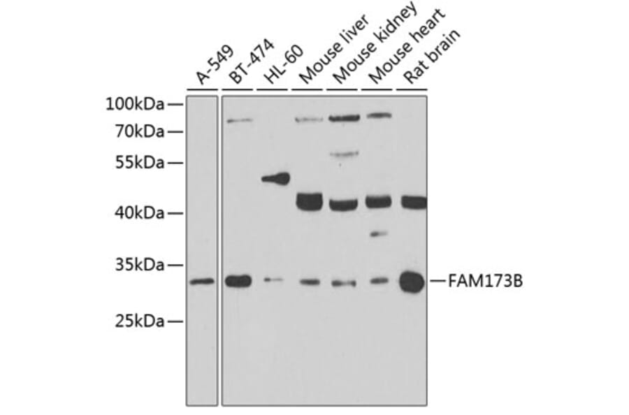 Western Blot - Anti-ATPSCKMT Antibody (A10140) - Antibodies.com