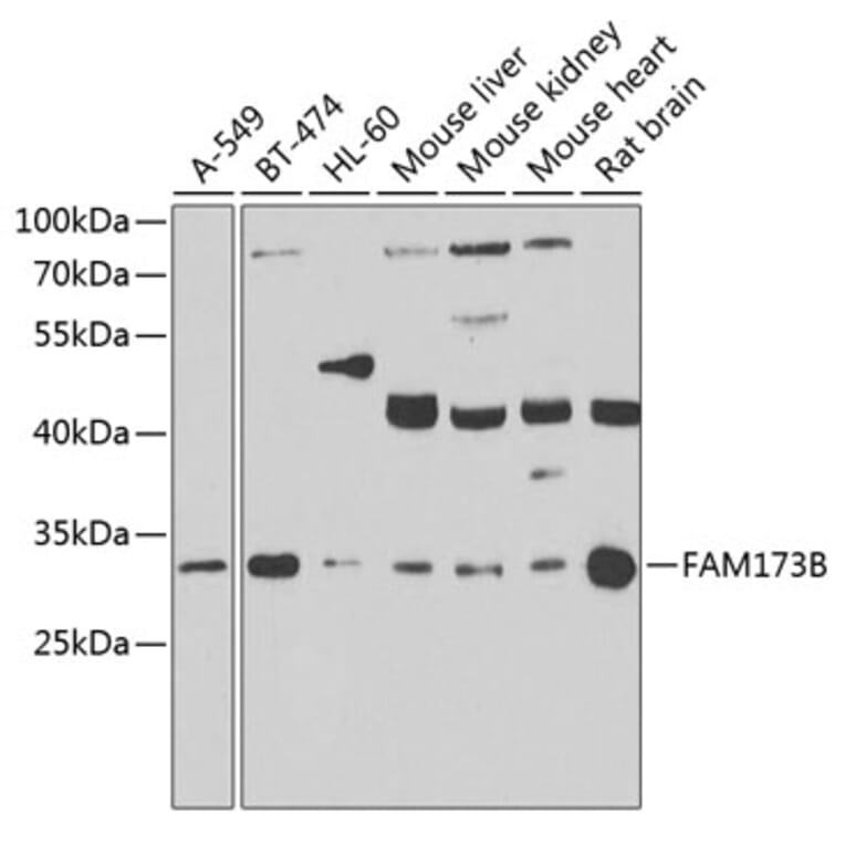 Western Blot - Anti-ATPSCKMT Antibody (A10140) - Antibodies.com