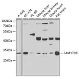 Western Blot - Anti-ATPSCKMT Antibody (A10140) - Antibodies.com
