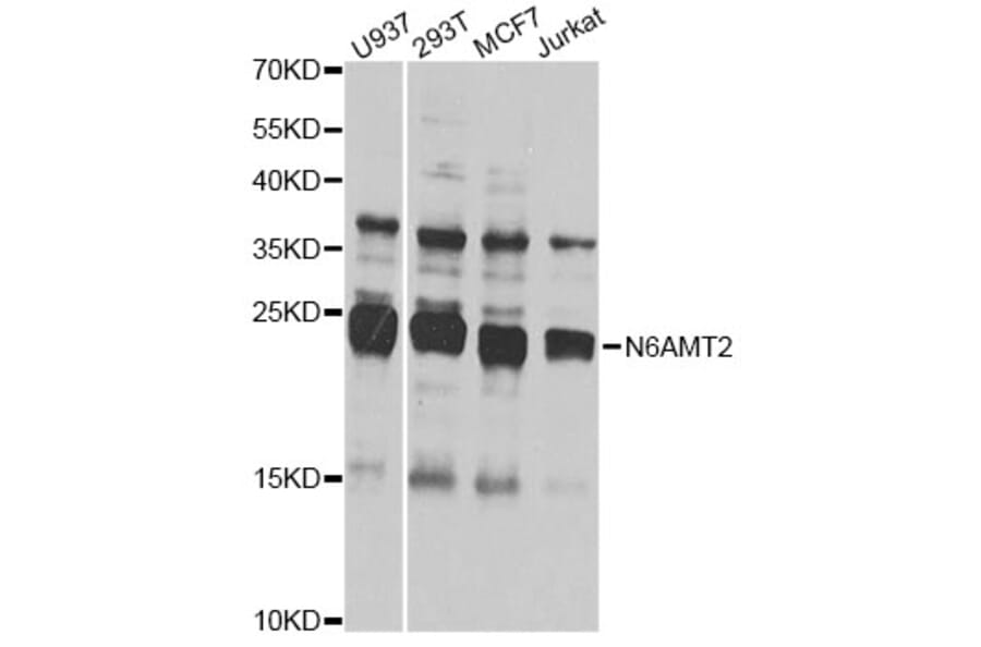 Western Blot - Anti-N6AMT2 Antibody (A7404) - Antibodies.com
