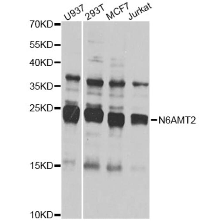 Western Blot - Anti-N6AMT2 Antibody (A7404) - Antibodies.com