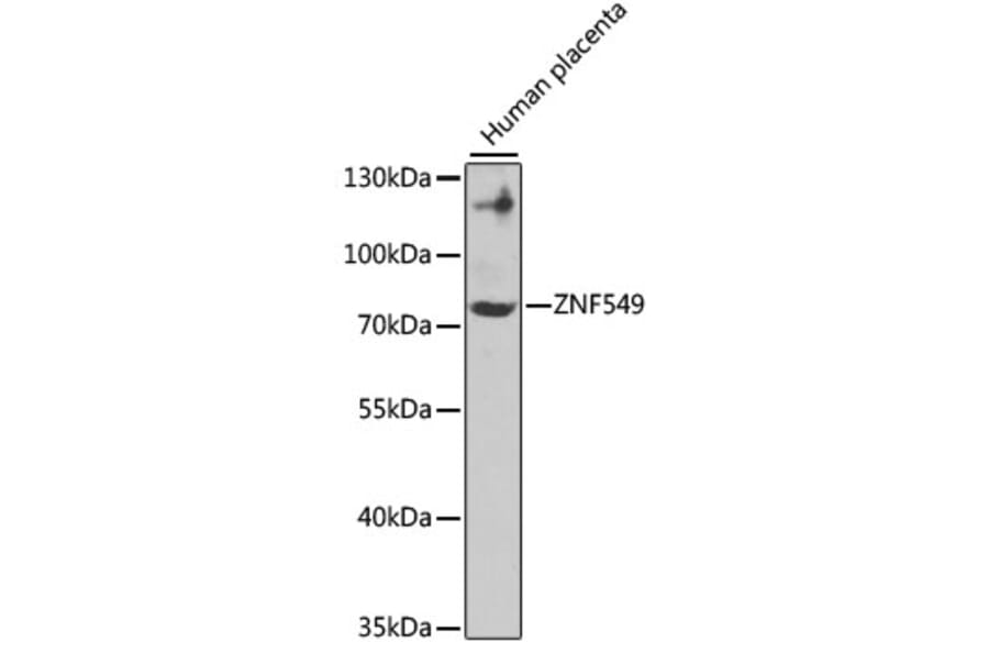 Western Blot - Anti-ZNF549 Antibody (A7405) - Antibodies.com