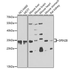 Western Blot - Anti-SPIN2B Antibody (A7407) - Antibodies.com