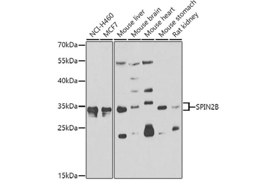 Western Blot - Anti-SPIN2B Antibody (A7407) - Antibodies.com
