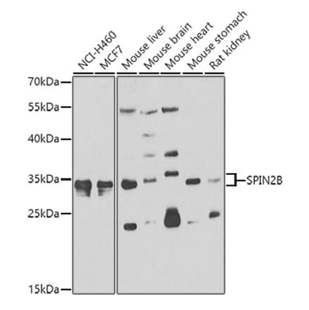 Western Blot - Anti-SPIN2B Antibody (A7407) - Antibodies.com