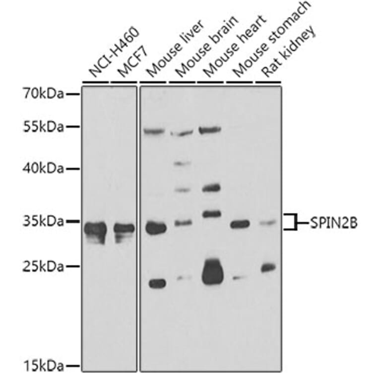 Western Blot - Anti-SPIN2B Antibody (A7407) - Antibodies.com