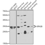 Western Blot - Anti-SPIN2B Antibody (A7407) - Antibodies.com