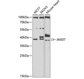 Western Blot - Anti-JMJD7 Antibody (A10145) - Antibodies.com