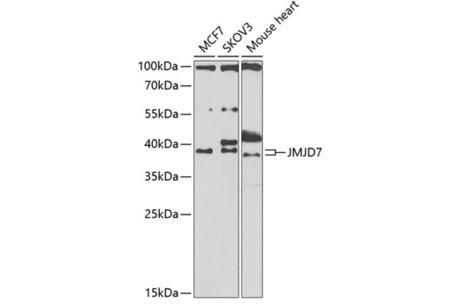 Western Blot - Anti-JMJD7 Antibody (A10145) - Antibodies.com