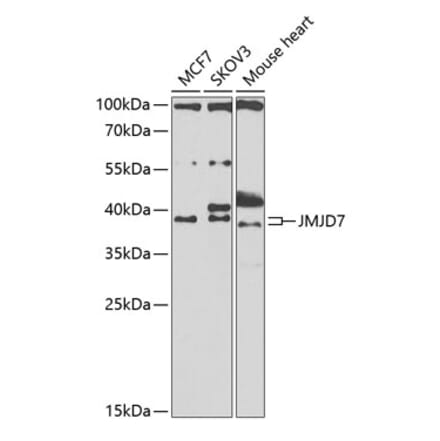 Western Blot - Anti-JMJD7 Antibody (A10145) - Antibodies.com