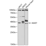Western Blot - Anti-JMJD7 Antibody (A10145) - Antibodies.com