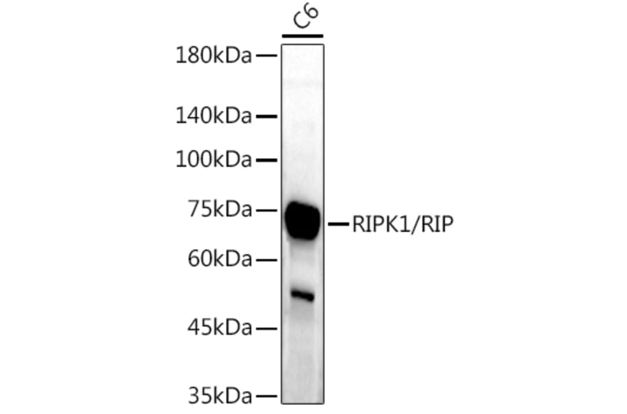 Western Blot - Anti-RIP Antibody (A10146) - Antibodies.com