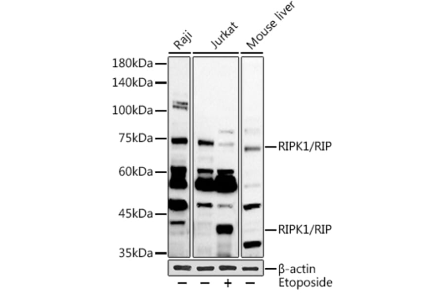 Western Blot - Anti-RIP Antibody (A10146) - Antibodies.com