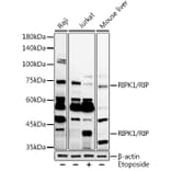 Western Blot - Anti-RIP Antibody (A10146) - Antibodies.com