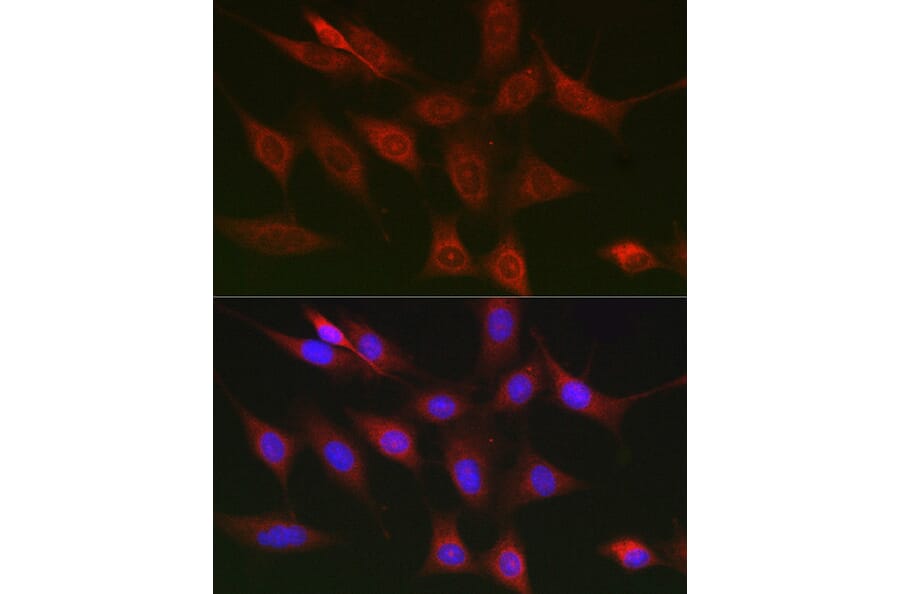 Immunofluorescence - Anti-RIP Antibody (A10146) - Antibodies.com