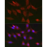 Immunofluorescence - Anti-RIP Antibody (A10146) - Antibodies.com