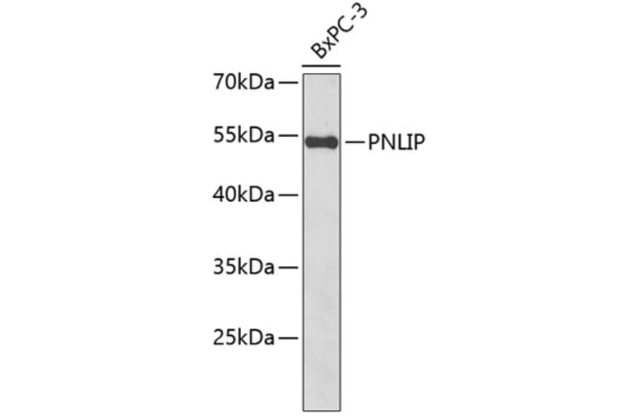 Western Blot - Anti-Pancreatic Lipase/PTL Antibody (A10149) - Antibodies.com