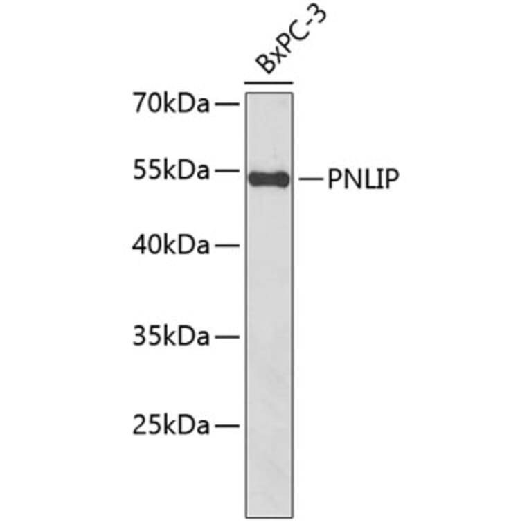 Western Blot - Anti-Pancreatic Lipase/PTL Antibody (A10149) - Antibodies.com