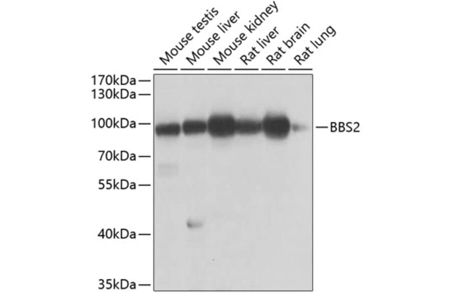 Western Blot - Anti-BBS2 Antibody (A10150) - Antibodies.com