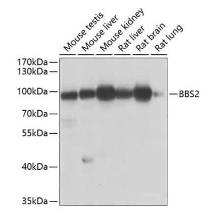 Western Blot - Anti-BBS2 Antibody (A10150) - Antibodies.com