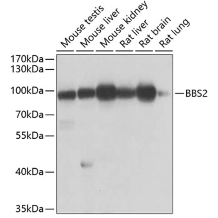 Western Blot - Anti-BBS2 Antibody (A10150) - Antibodies.com
