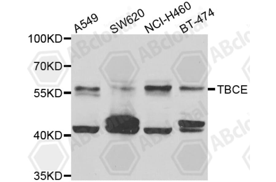 Western Blot - Anti-TBCE Antibody (A7453) - Antibodies.com