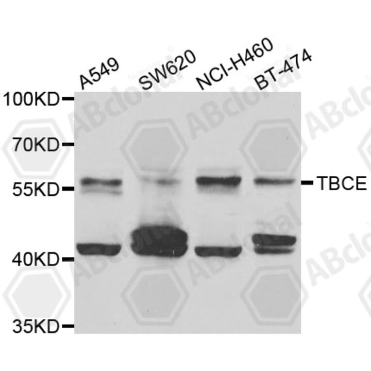 Western Blot - Anti-TBCE Antibody (A7453) - Antibodies.com