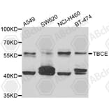Western Blot - Anti-TBCE Antibody (A7453) - Antibodies.com