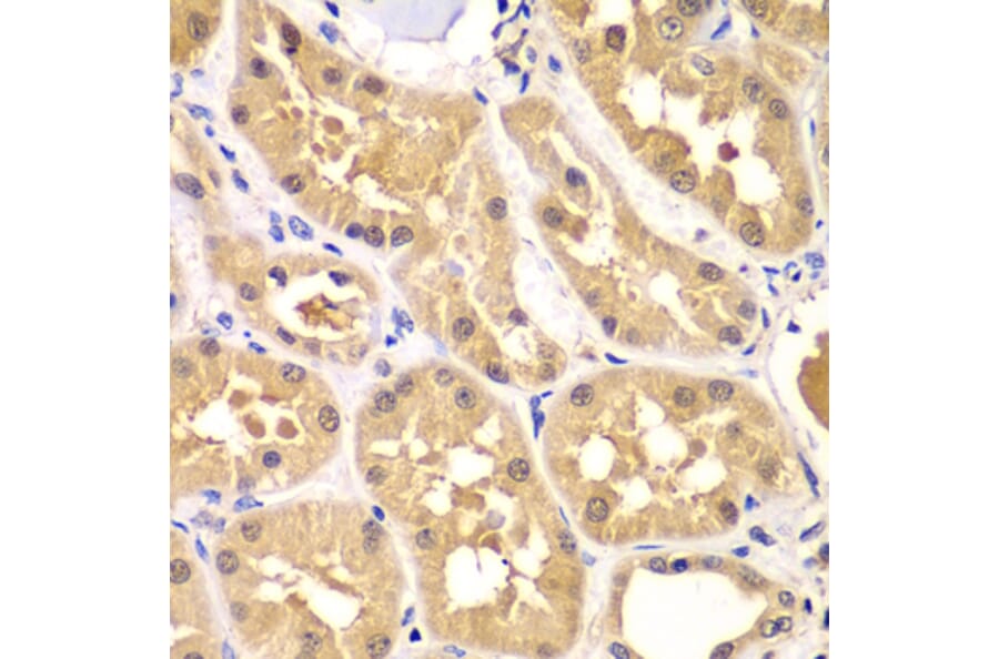 Immunohistochemistry - Anti-PRKAG3 Antibody (A7470) - Antibodies.com