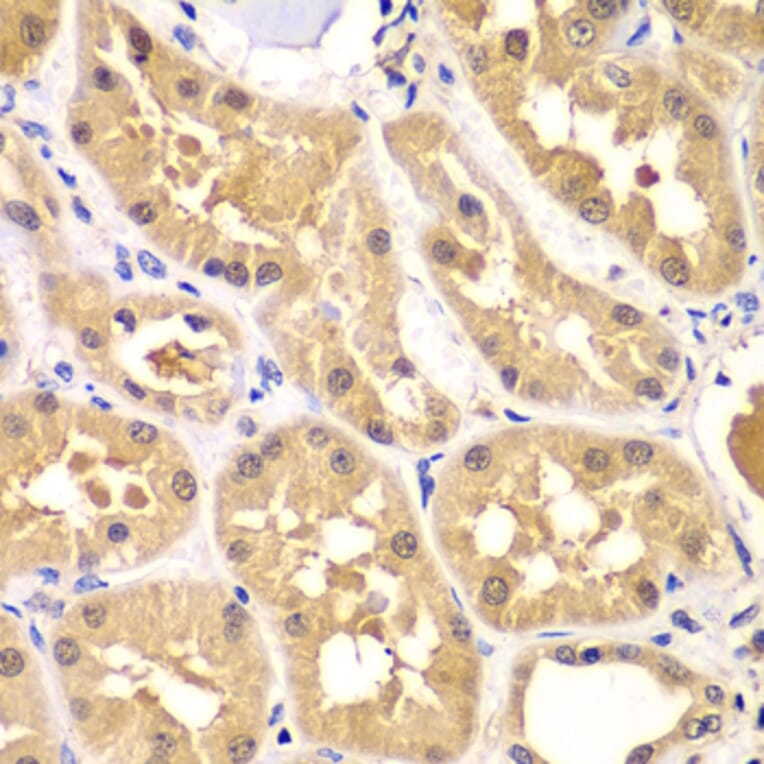 Immunohistochemistry - Anti-PRKAG3 Antibody (A7470) - Antibodies.com