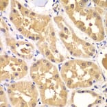 Immunohistochemistry - Anti-PRKAG3 Antibody (A7470) - Antibodies.com