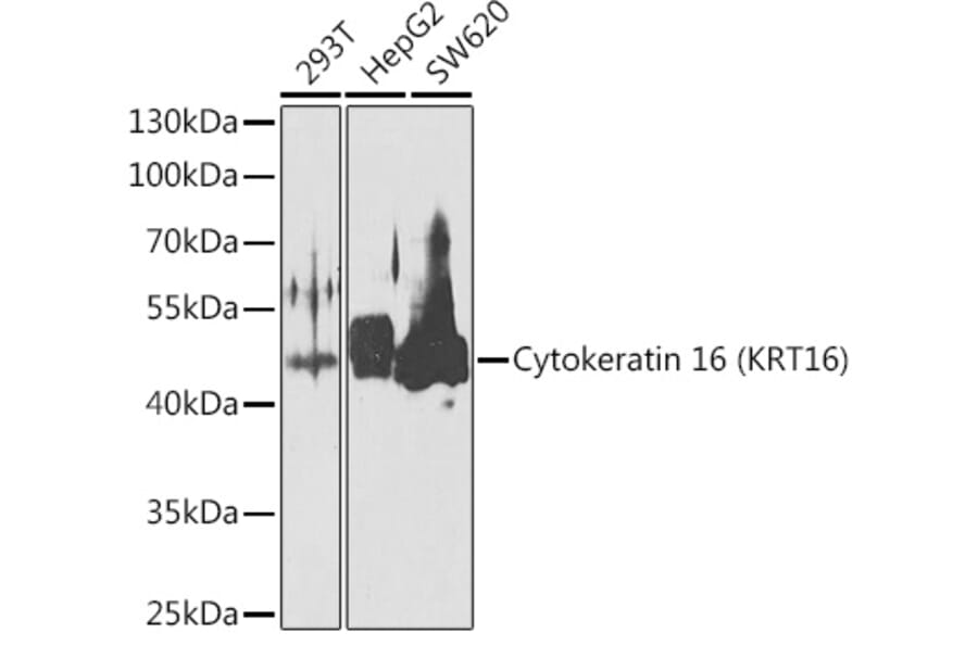 Western Blot - Anti-Cytokeratin 16/K16 Antibody (A10153) - Antibodies.com