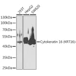 Western Blot - Anti-Cytokeratin 16/K16 Antibody (A10153) - Antibodies.com