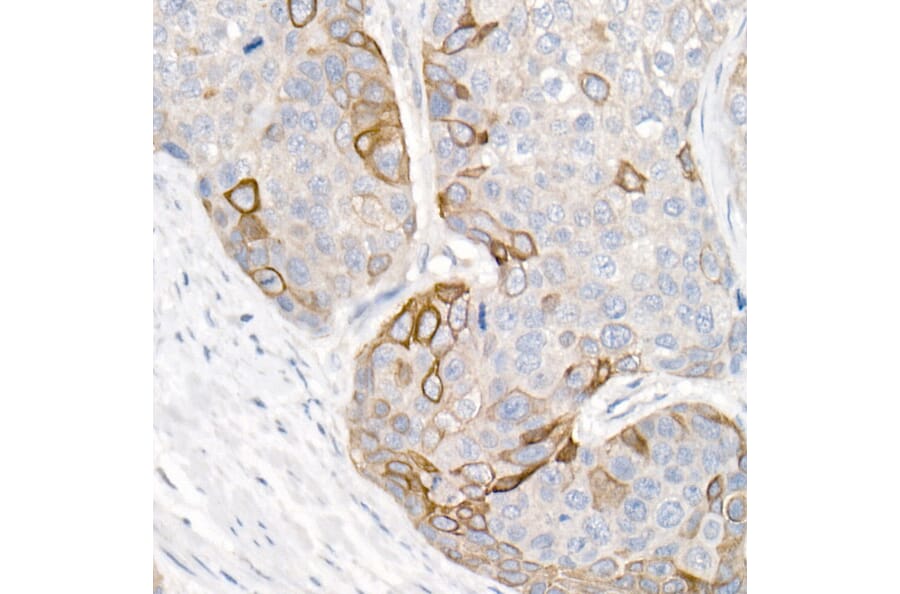 Immunohistochemistry - Anti-Cytokeratin 16/K16 Antibody (A10153) - Antibodies.com
