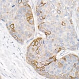 Immunohistochemistry - Anti-Cytokeratin 16/K16 Antibody (A10153) - Antibodies.com