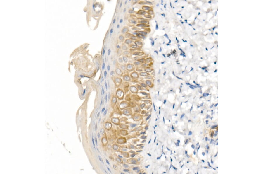 Immunohistochemistry - Anti-Cytokeratin 16/K16 Antibody (A10153) - Antibodies.com